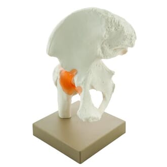 Hofteledd, modell på plate