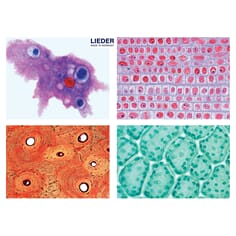 Mikropreparatsett,Generell biologi sett,25 preparater,Lieder