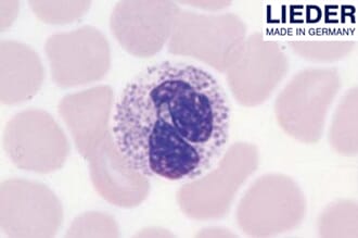 Blodutstryk, menneske, røde/hvite blodlegemer, 1 stk,Lieder