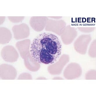 Blodutstryk menneske, Wright-farging, Lieder