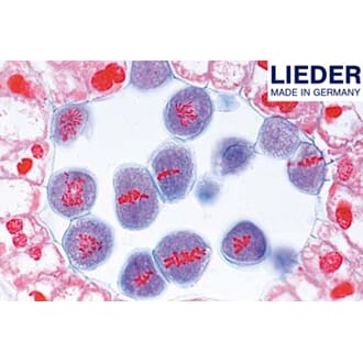 Meiose, tverrsnitt av lilje, Lieder